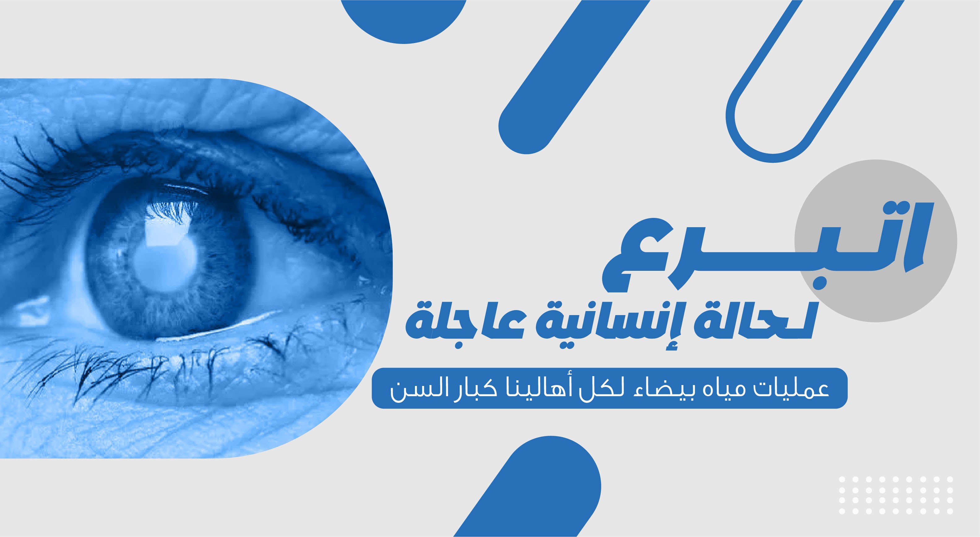 حالة إنسانية عاجلة (عمليات مياه بيضاء لكل أهالينا كبار السن)